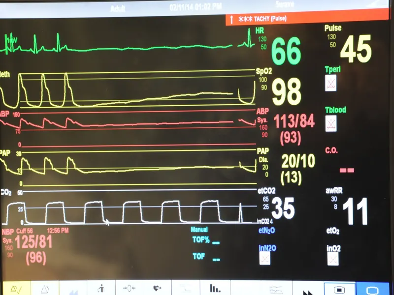 Patient Monitors — representative photo