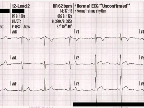 Cardiology — representative photo