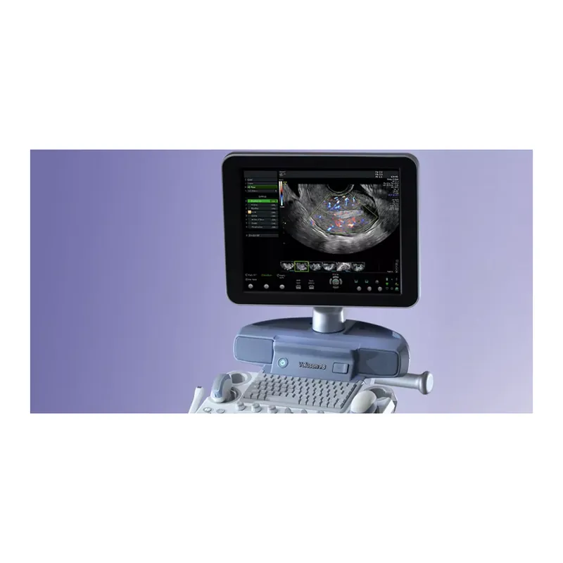GE Healthcare Voluson P8 Ultrasound (refurbished)